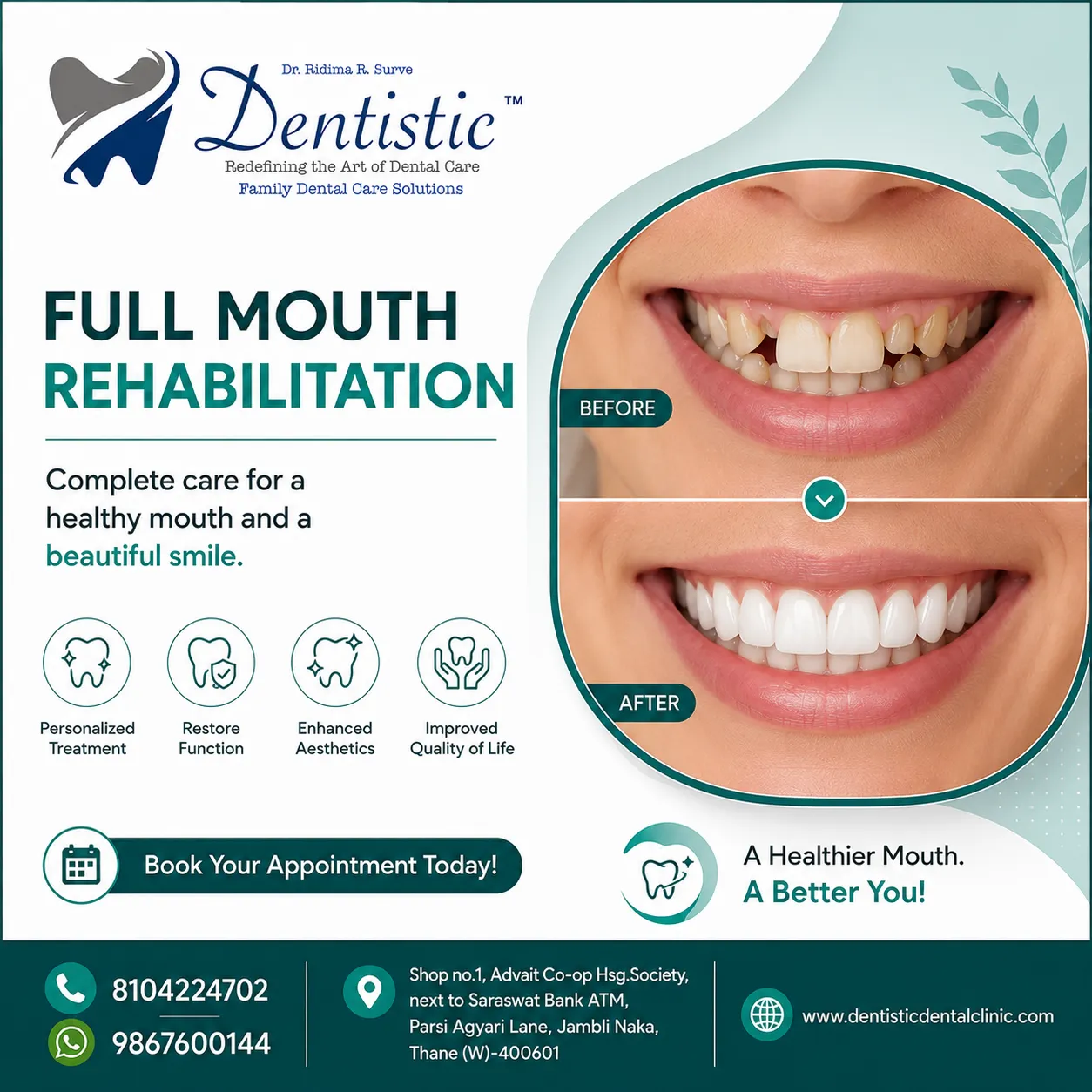 Full Mouth Rehabilitation in Panchpakadi, Thane