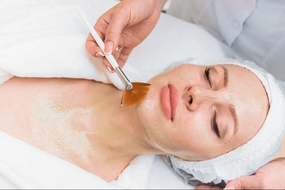 Chemical Peel for Glowing Skin in Belapur for Clear and Radiant Complexion