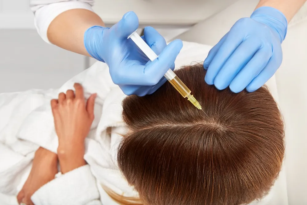 Hair Regeneration therapy with PRP at Rakesh Reddy's Skin Clinic in Sanjay Nagar.