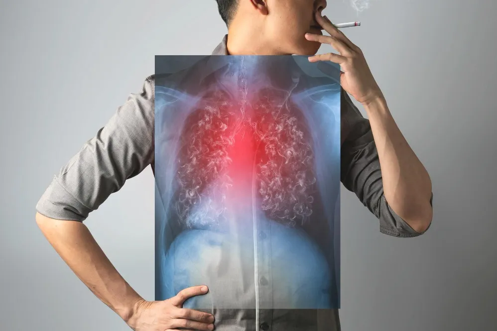 Smoking-Related Breathing Problem Specialist in Pune Recognising Early Changes in Lung Function