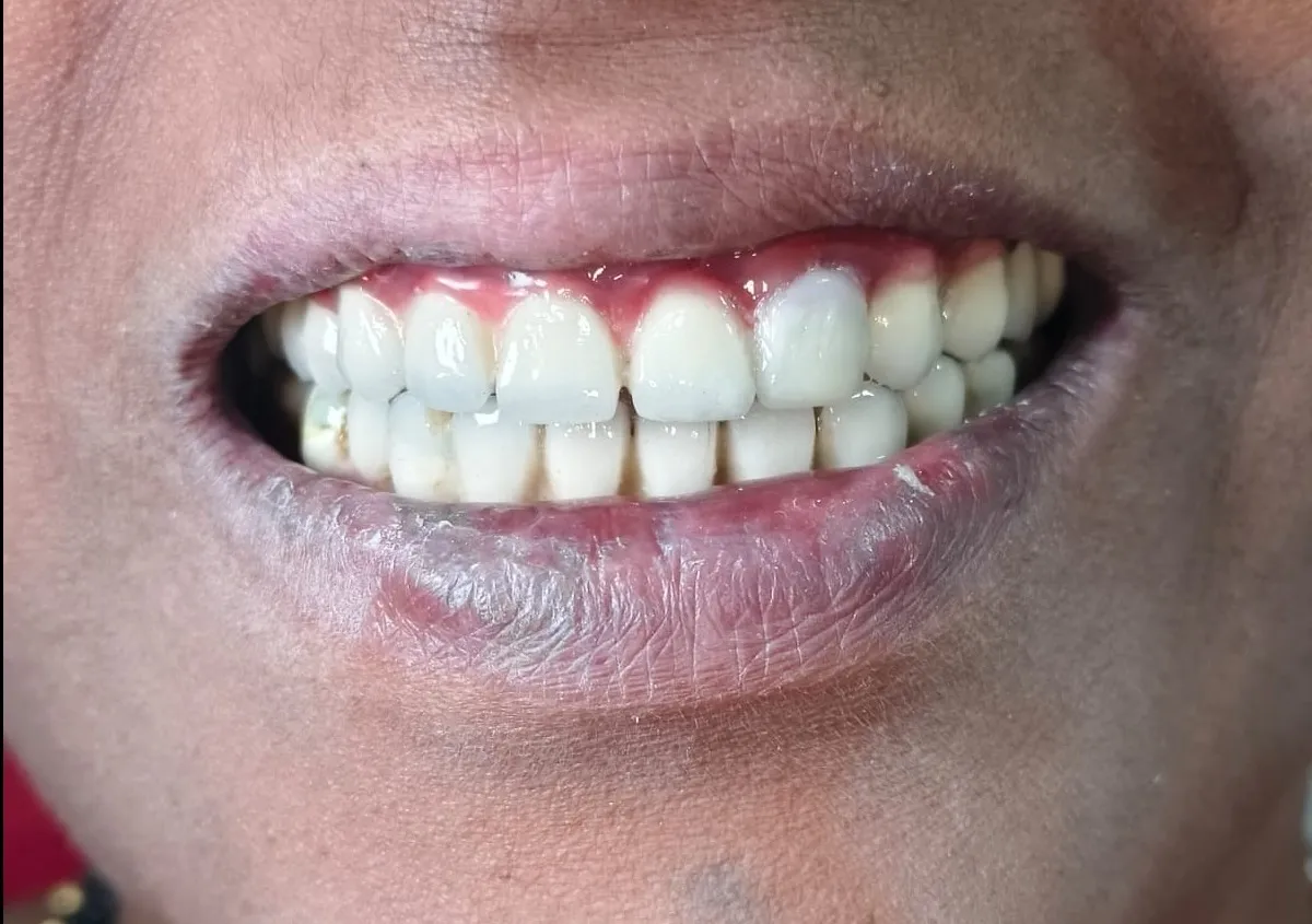 Best Dentist in Thane (Nitin Company) for Dental Implants: What Patients Should Know