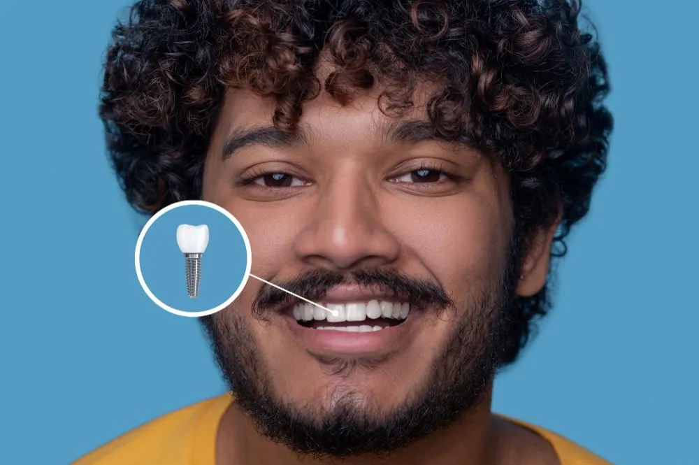 Same Day Dental Implants in Nehru Place – Faster Solutions for Missing Teeth