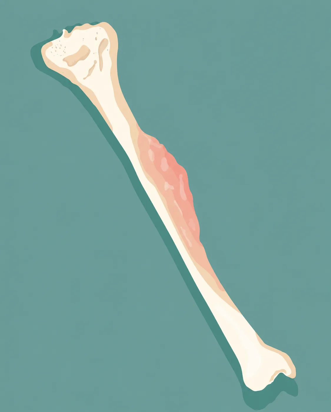 Bone Cancer Treatment in Mumbai Early Diagnosis Matters