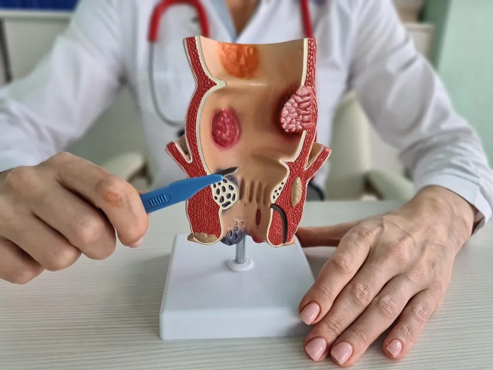 Dedicated lady surgeon for anorectal treatments in Thane