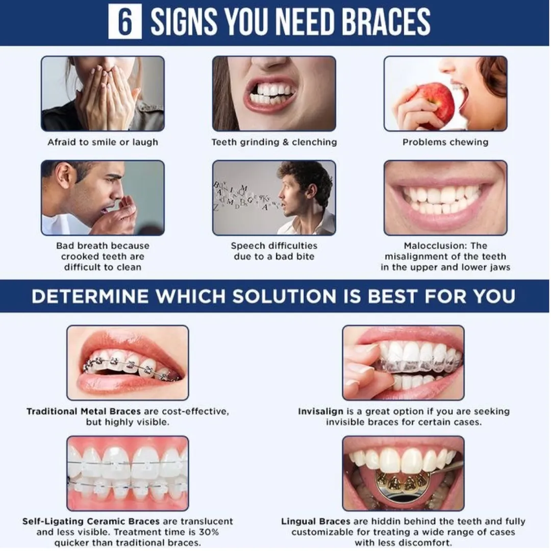 When Does a Child Need Braces? Signs Parents in South Delhi Should Watch For