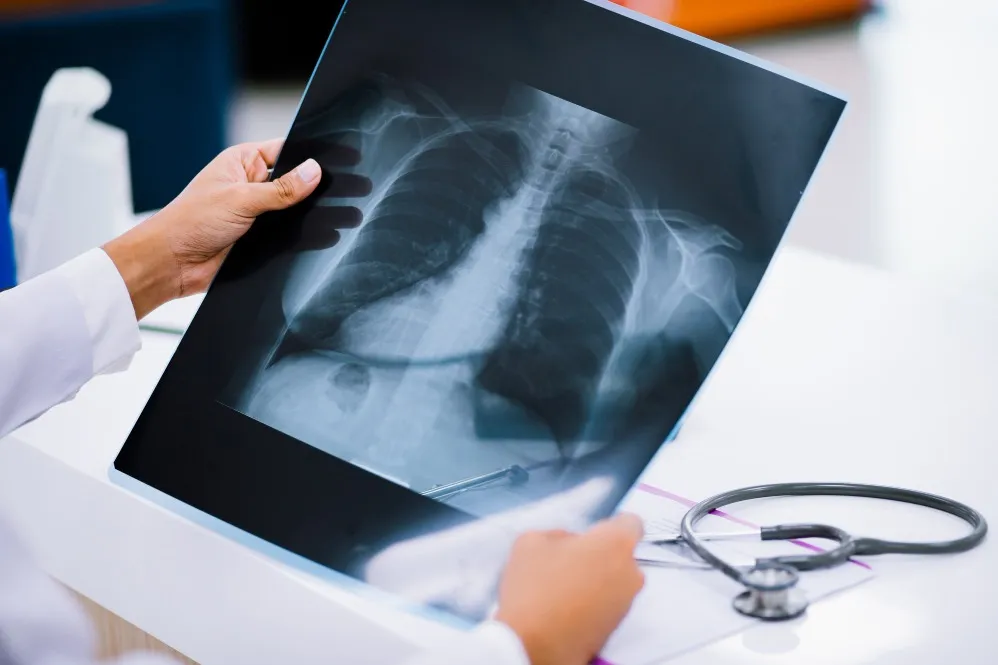 X-Ray in Thane