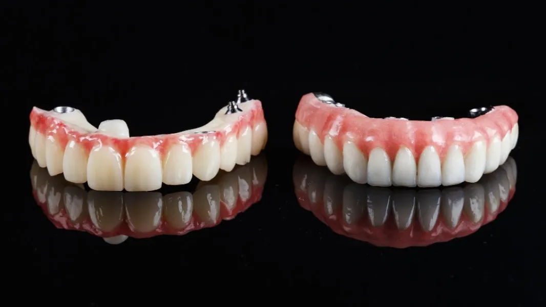 Best Affordable Implant Dentures Clinic in Delhi for Long-Term Tooth Replacement