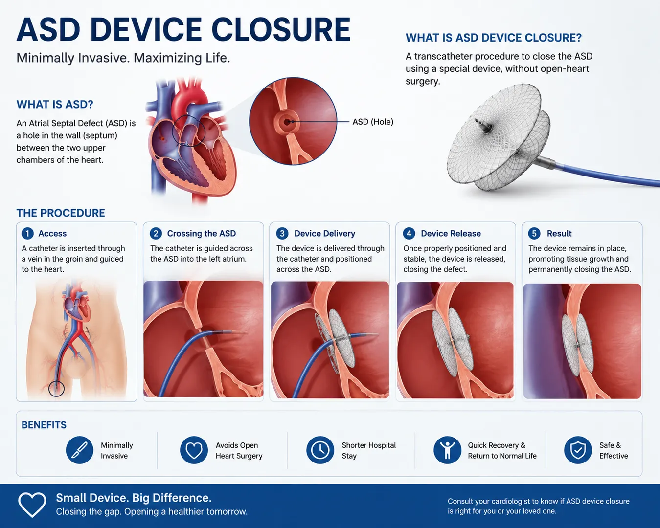 ASD Device Closure in Navi Mumbai – Treating Atrial Septal Defects with Precision