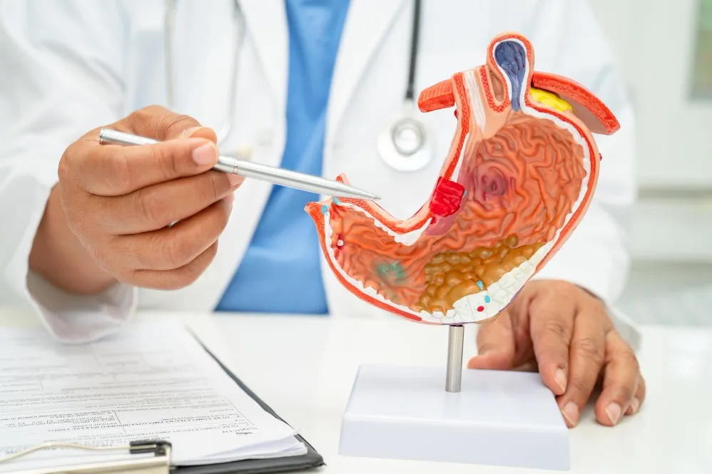 Hiatus Hernia Repair in Mumbai for Chronic Acidity and Reflux Problems