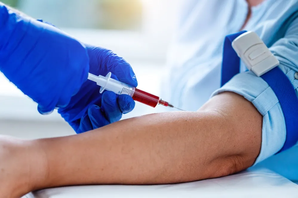 Affordable Blood Test Near Me In Dwarka For Regular Health Checkups