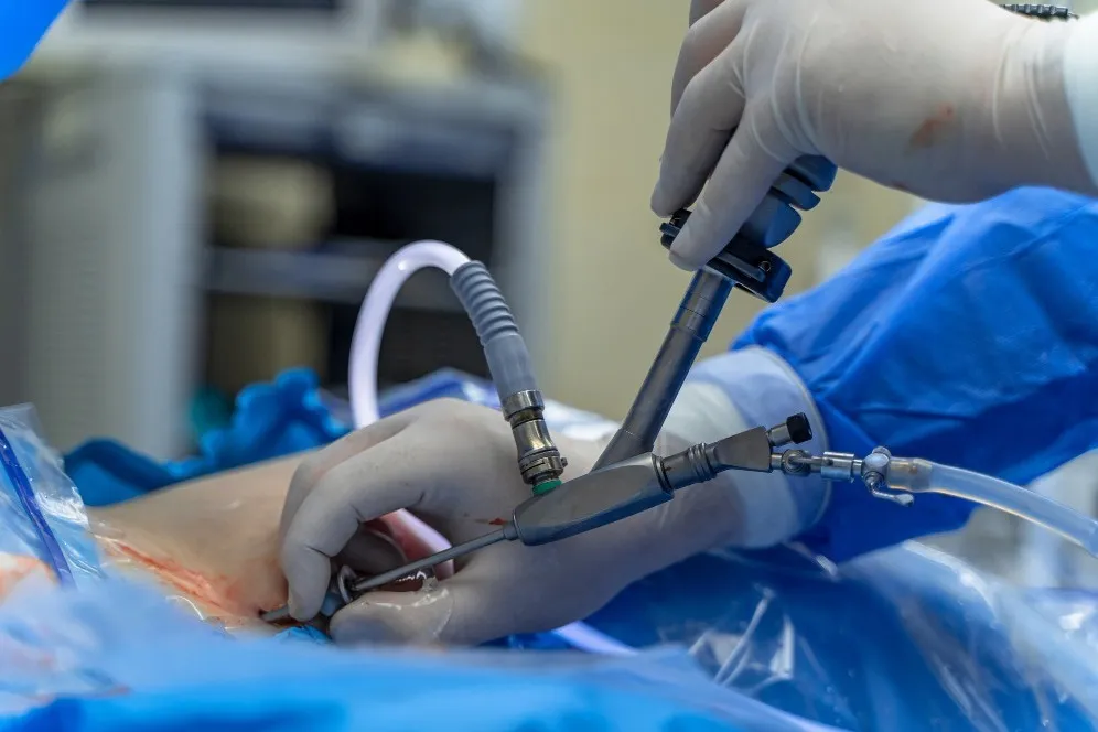 Best Laparoscopic Surgery Hospital in Mansarovar