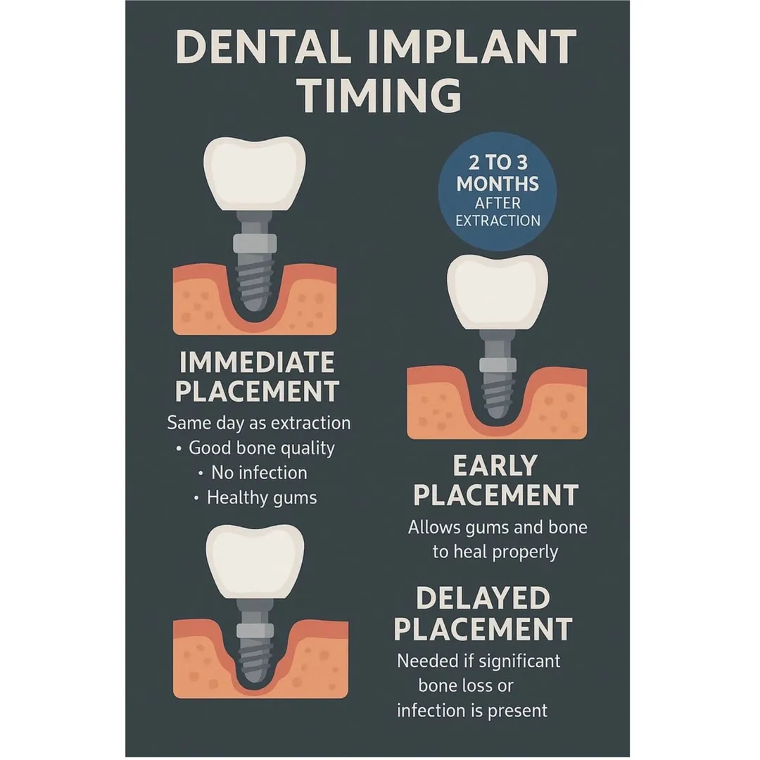 Immediate Dental Implants: Fast, Reliable Tooth Replacement Near South Delhi