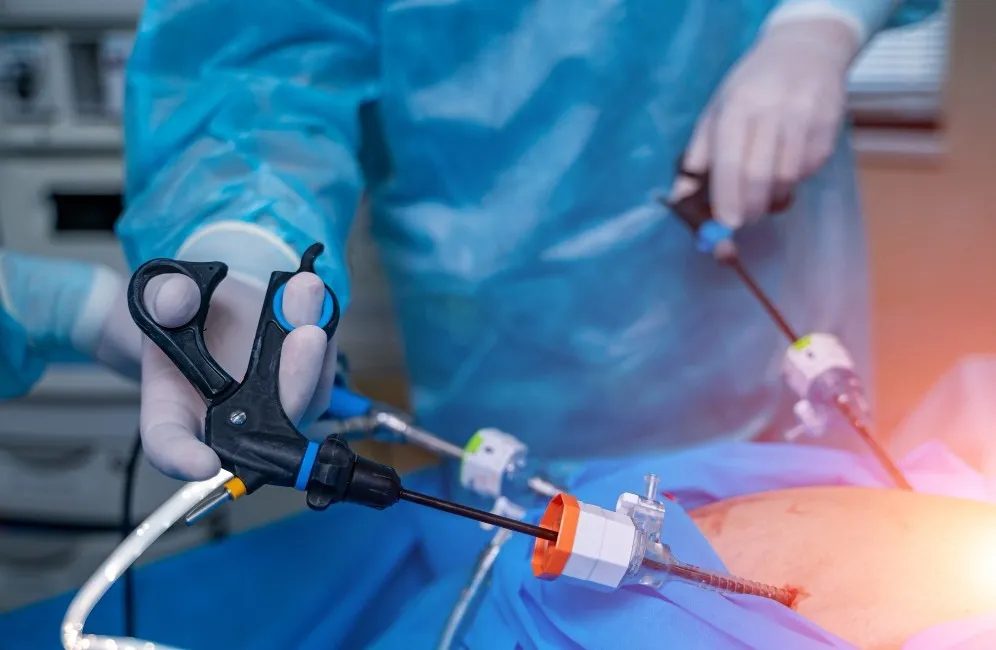 Laparoscopic Achalasia Cardia Repair in Mumbai for Swallowing Difficulties