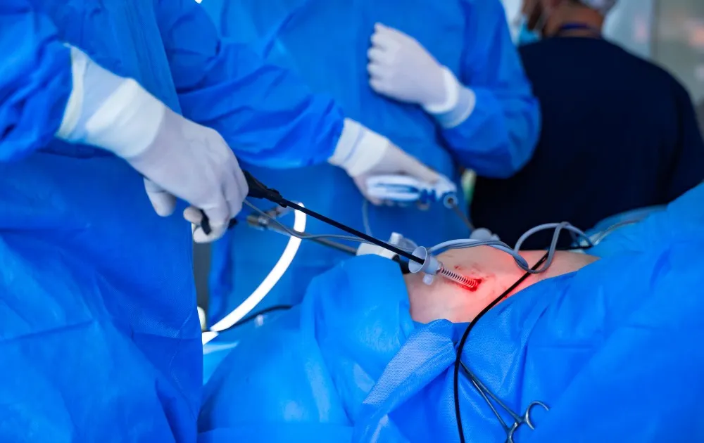 Laparoscopic Adrenalectomy in Byculla Minimally Invasive Surgery for Adrenal Gland Disorders