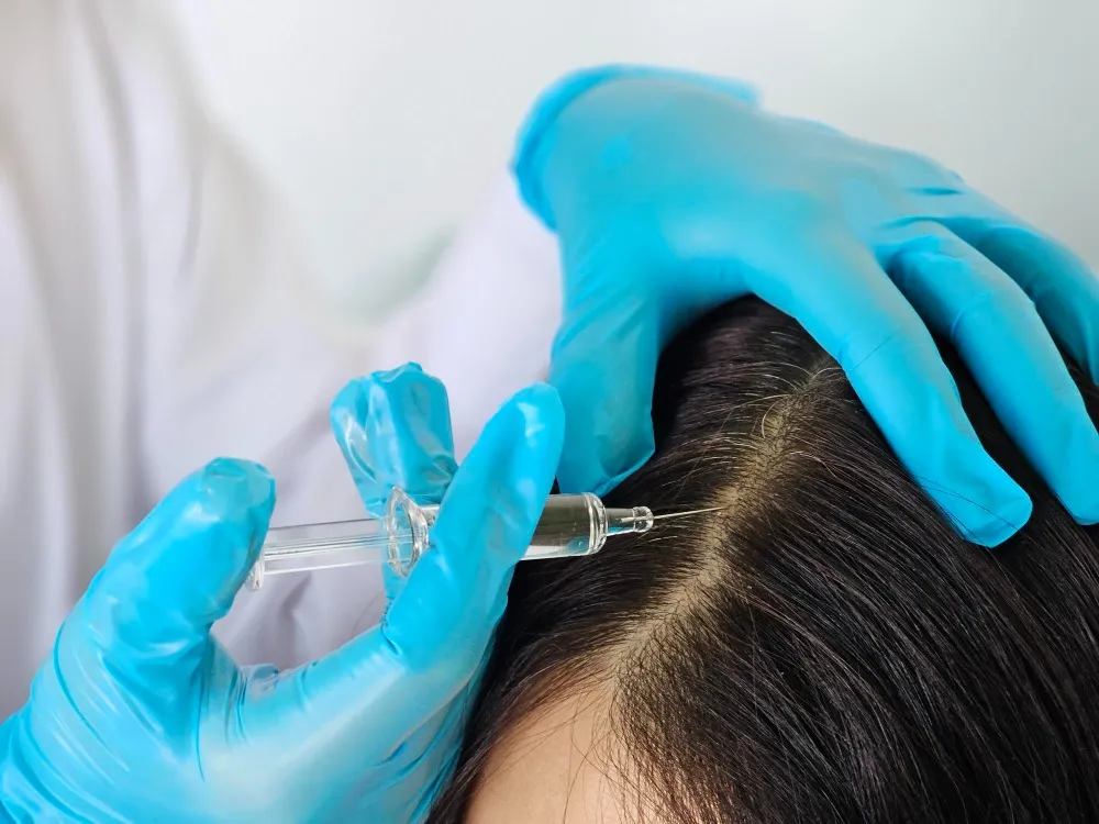 Hair Loss Treatment in Vijayanagar