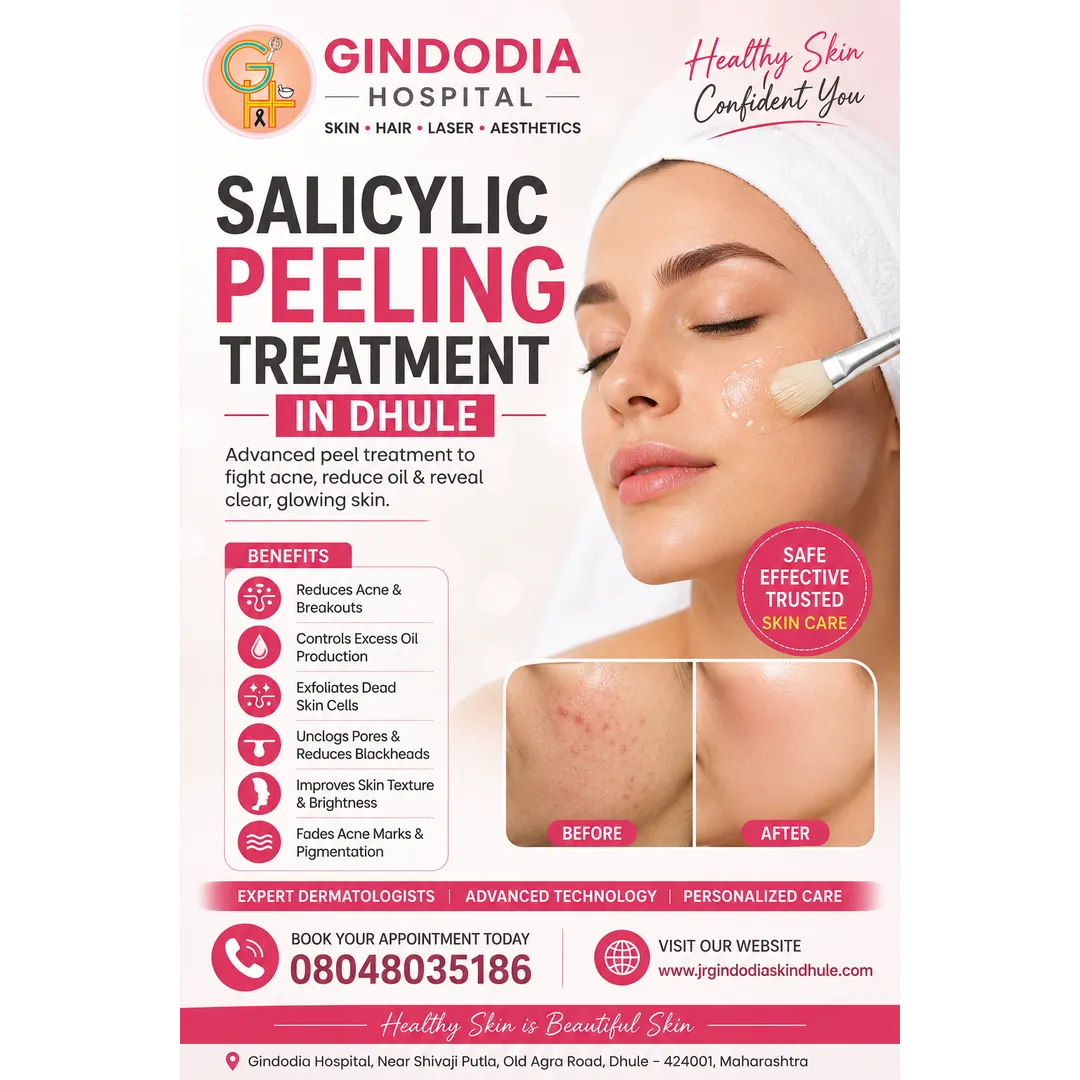 Salicylic Peeling Treatment in Dhule | Gindodia Hospital