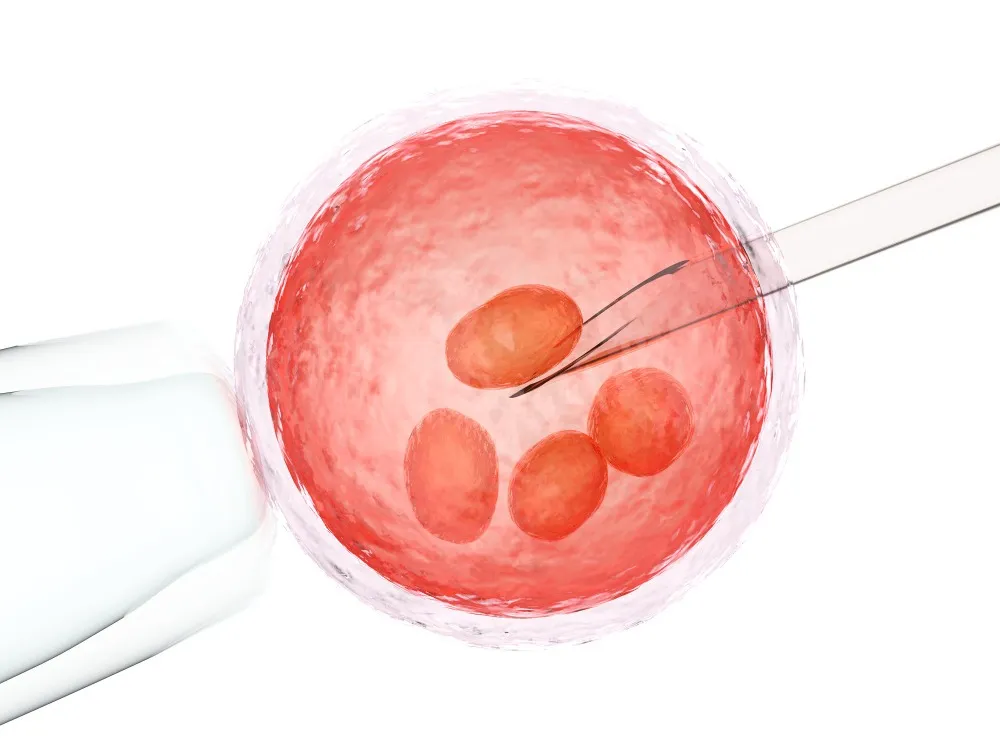 Laser Hatching Treatment in Nashik Supporting Embryo Implantation During IVF