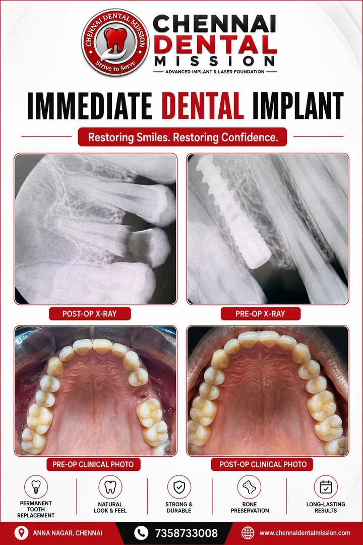 Can a missing tooth affect the teeth next to it?