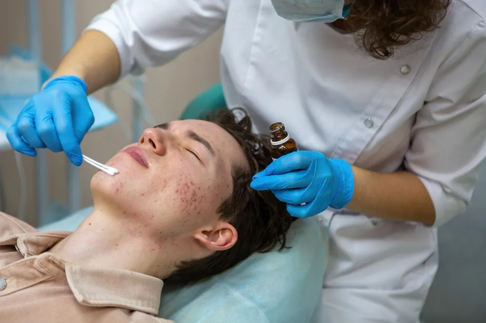Adult Acne Treatment for Sensitive Skin: Safe and Effective Ways to Achieve Clearer Skin