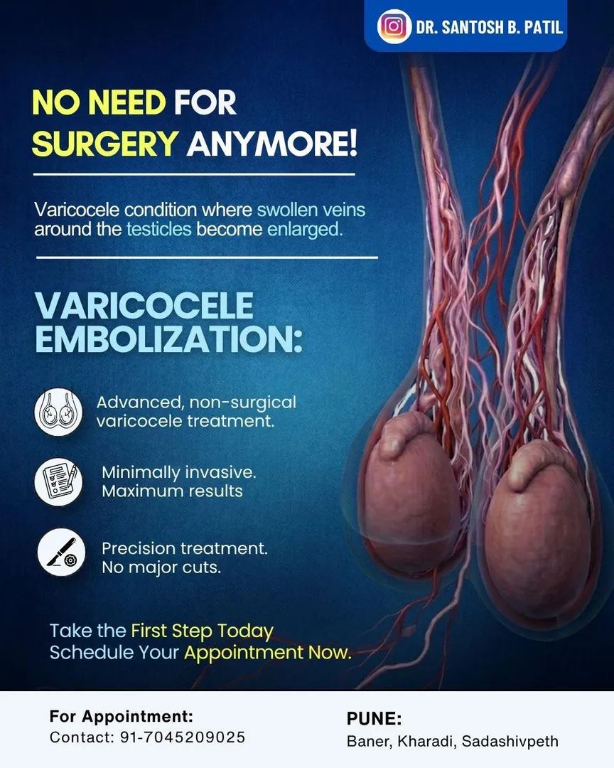 Best Varicocele embolization non surgical treatment in pune