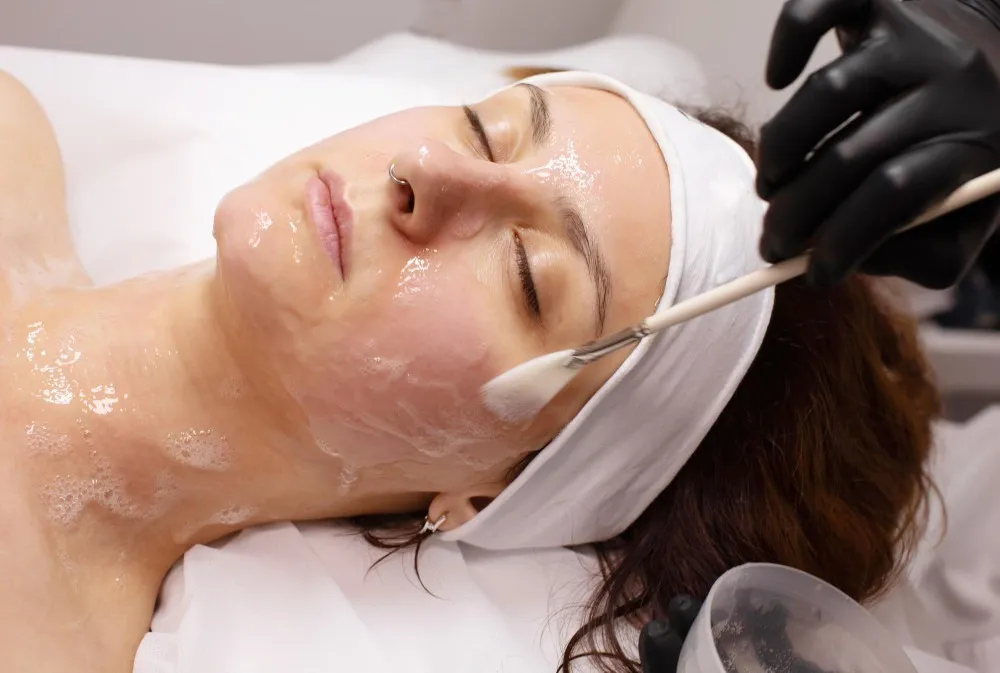 preview Chemical Peels in Pune – Giving Dull Skin a Fresh Start