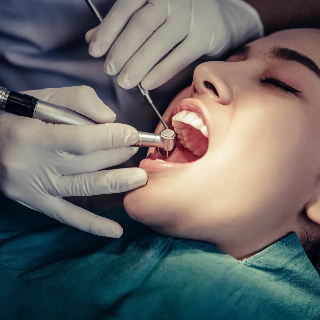 Root Canal Treatment in Kothrud
