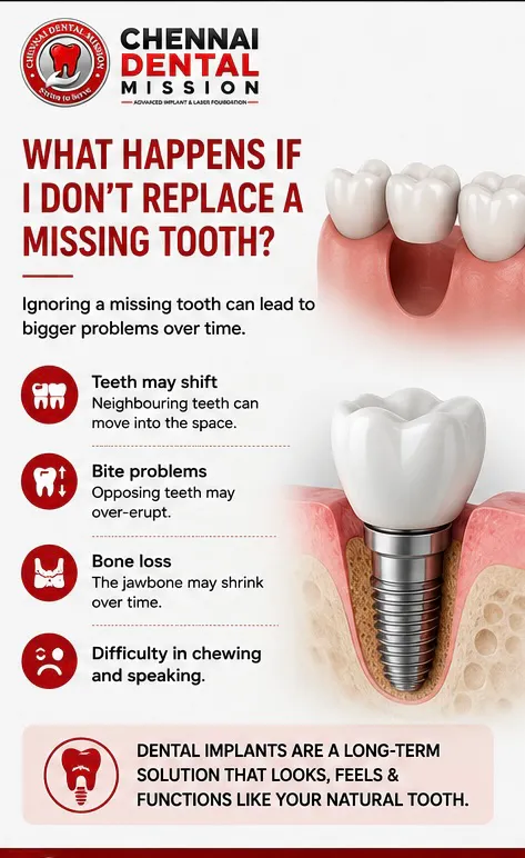 What happens if I don't replace a missing tooth?
