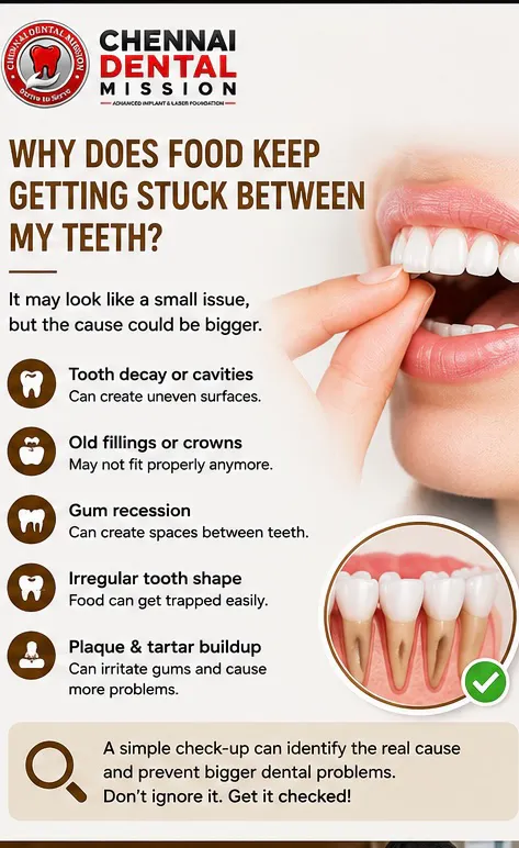 Why does food keep getting stuck between my teeth?