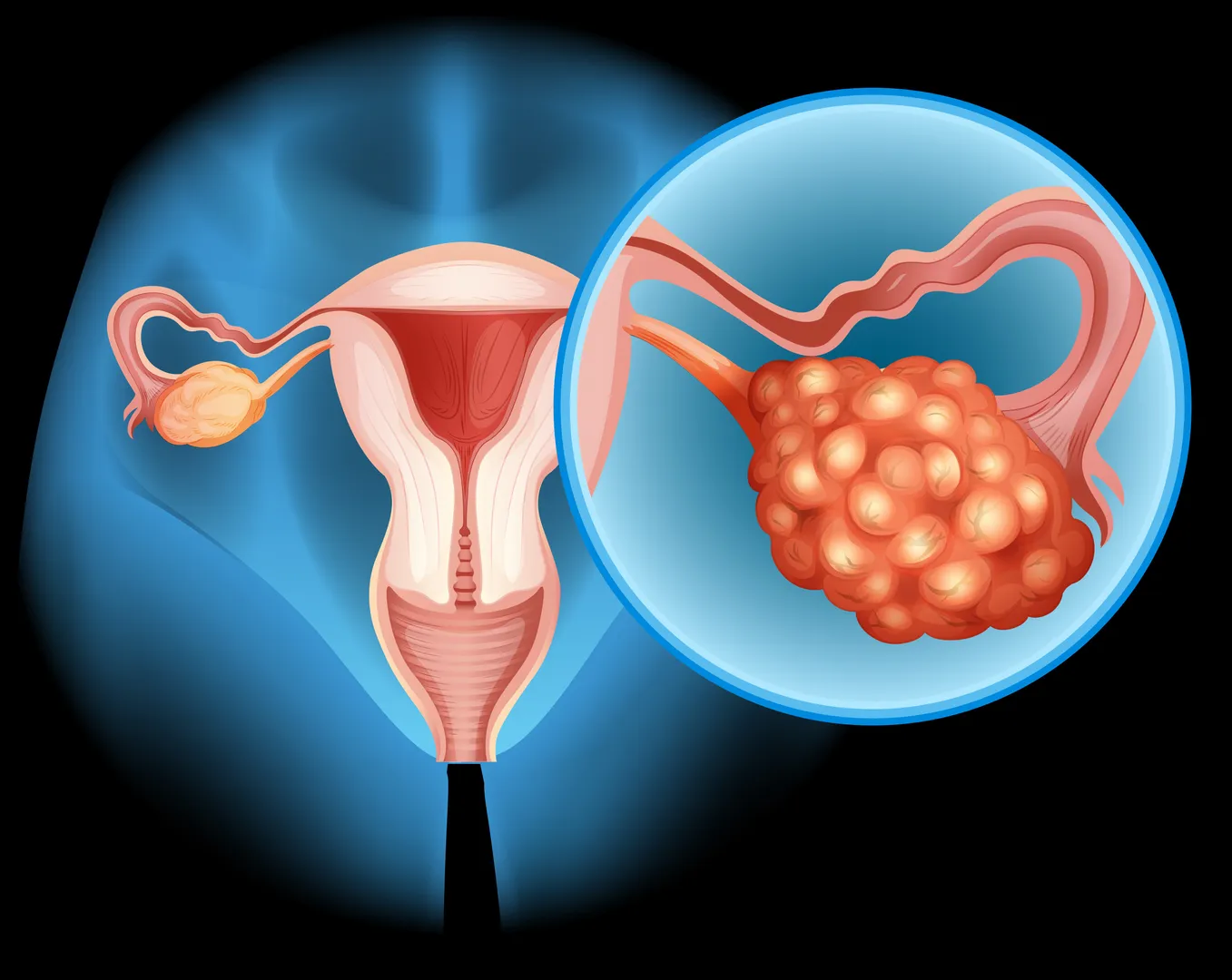 Tubal Ligation Surgery Hospital in Mumbai Understanding Permanent Family Planning Options