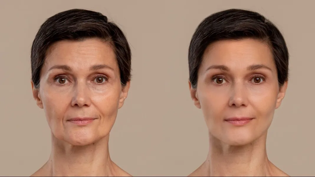 Early Signs of Skin Aging and Prevention: What Your Skin May Be Trying to Tell You