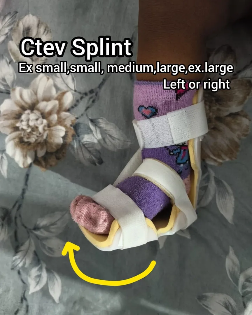 Ctev Splint – Available in Kalwa West Thane