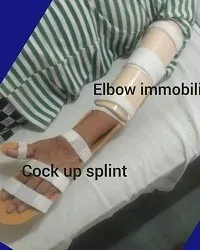 Elbow Immobilizer Cock Up Splint – Available In Kalwa West