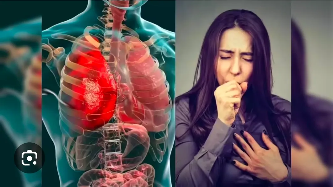 टीबी (Tuberculosis) के डाक्टर विधाधर नगर जयपुर