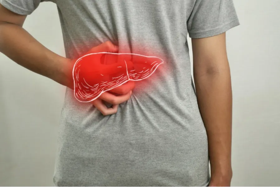 Understanding Alcoholic Liver Disease: Early Signs, Treatment Options, and When to Seek Medical Care