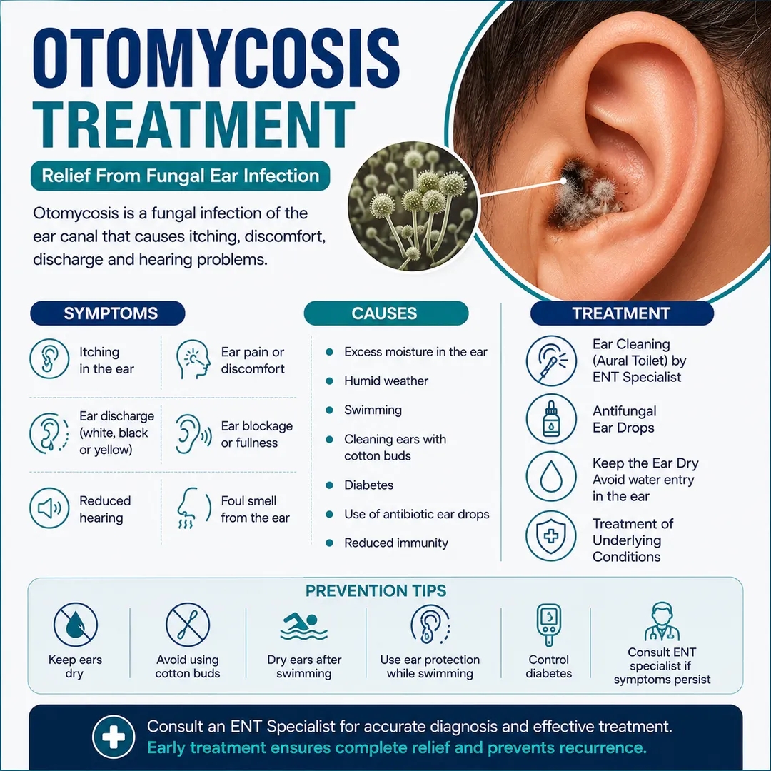 Otomycosis Treatment | Fungal Ear Infection Treatment & Symptoms