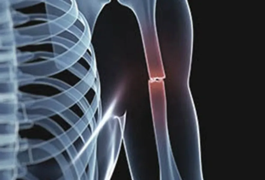 Trauma & Fracture Specialist in Bibwewadi, Dhankawadi, Pune |