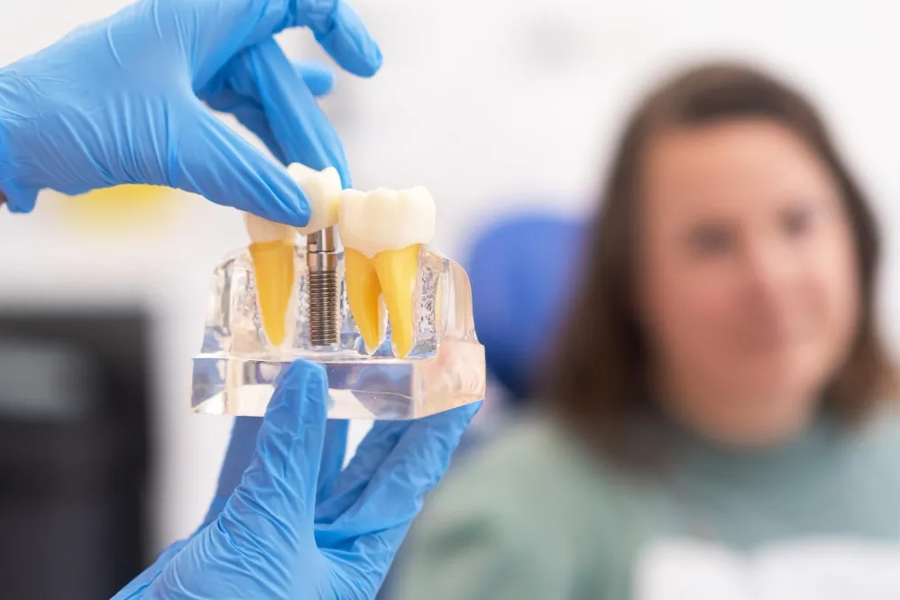 Best Implant Clinic in Vikas Puri – Restoring Missing Teeth with Modern Solutions