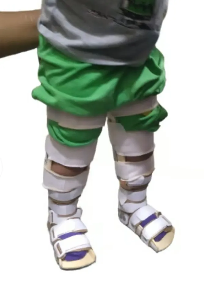Ankle and Knee Stability Splint for CP (Central Palsy) Child Available in Kalwa West Thane
