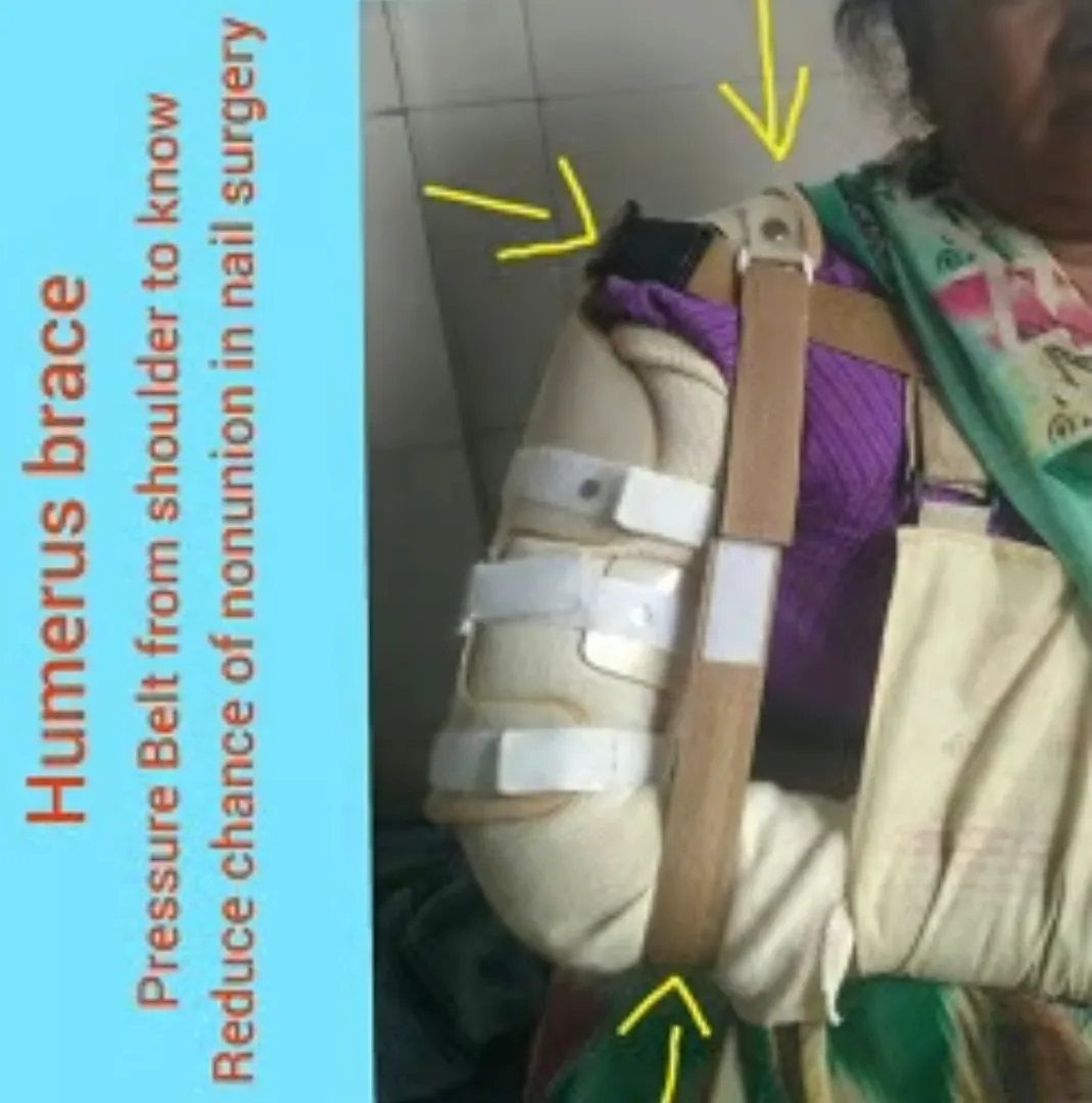 Humerus Corset Available in Kalwa West Thane