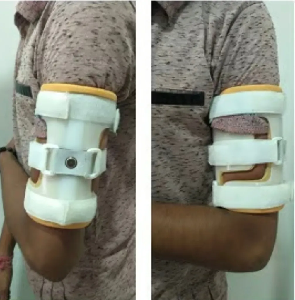 Humerus Corset Available in Kalwa West Thane