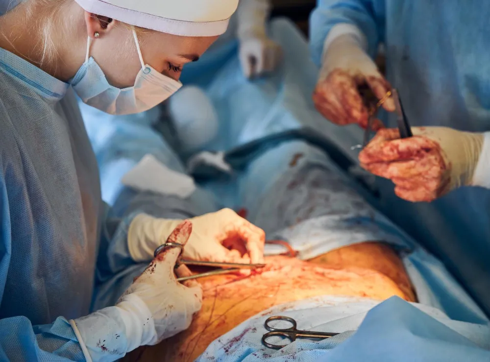Hydatid Cyst Excision in Mazgaon Minimally Invasive Treatment for Hydatid Disease