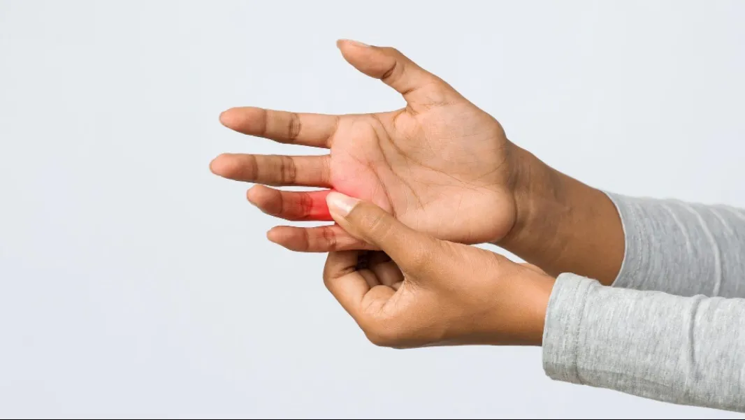 Trigger Finger Release: Understanding Why a Finger Gets Stuck and How It Can Be Treated