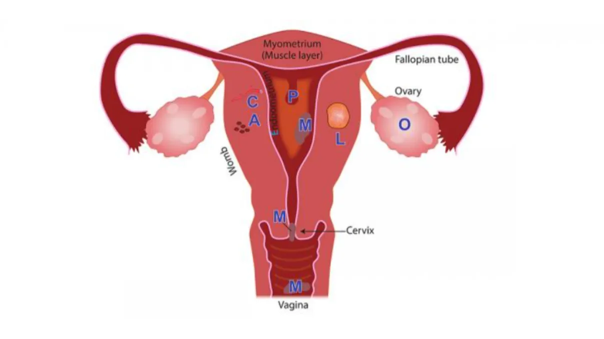 Menstrual Disorders Treatment in Thane - Understanding What Your Cycle Is Telling You