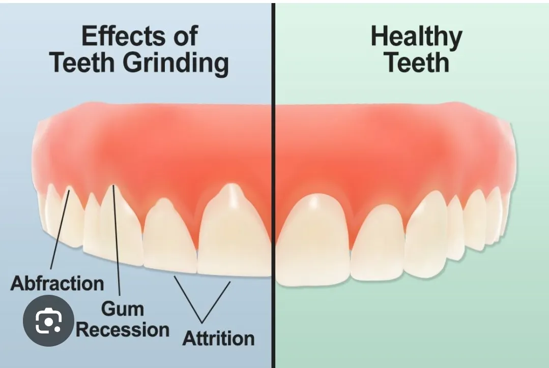 best dentist doctor in wadgaonsheri - Bandewar clinic