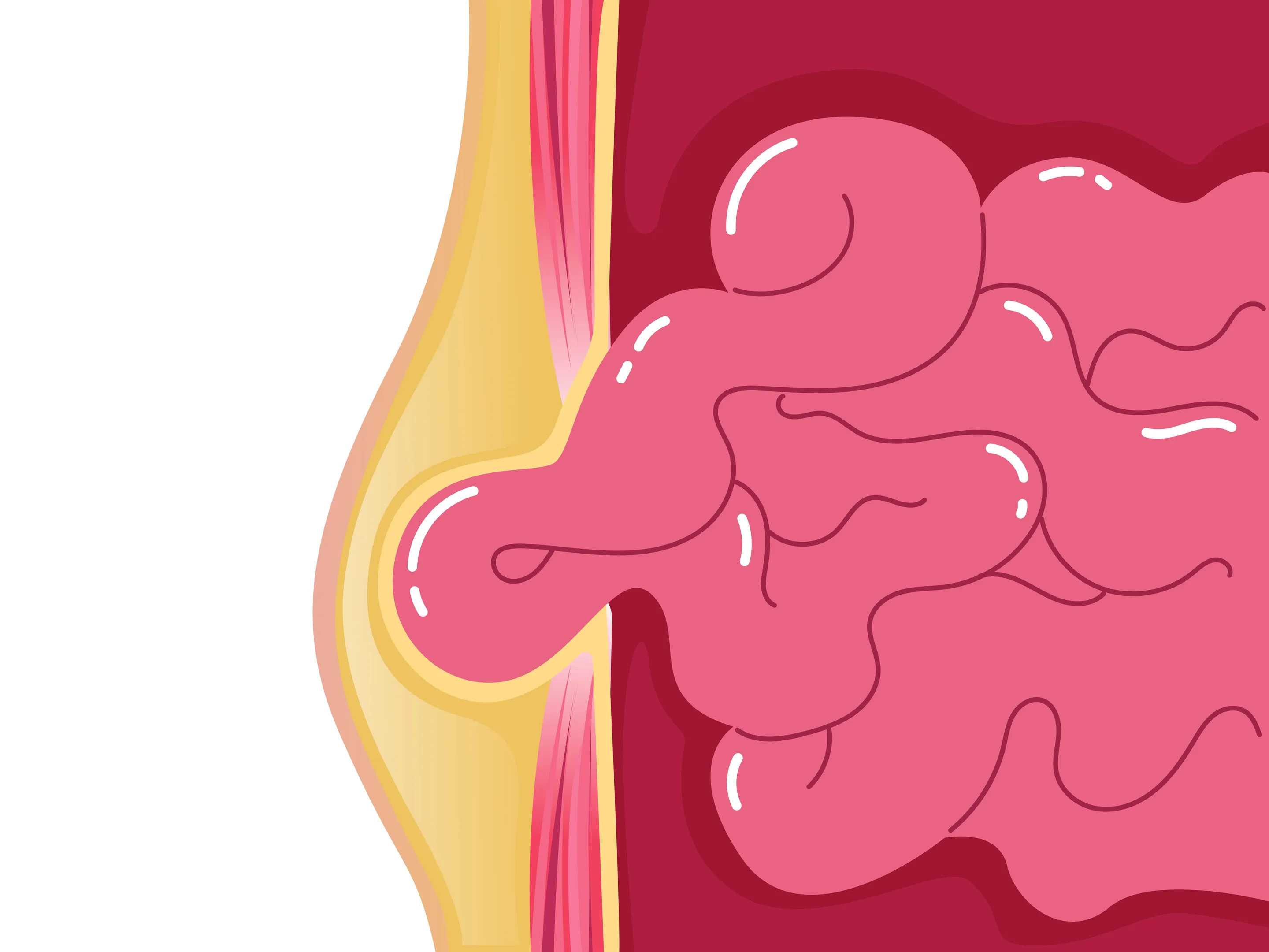 Hernia Specialist Surgeon Ahmedabad: Early Warning Signs You Should Never Ignore