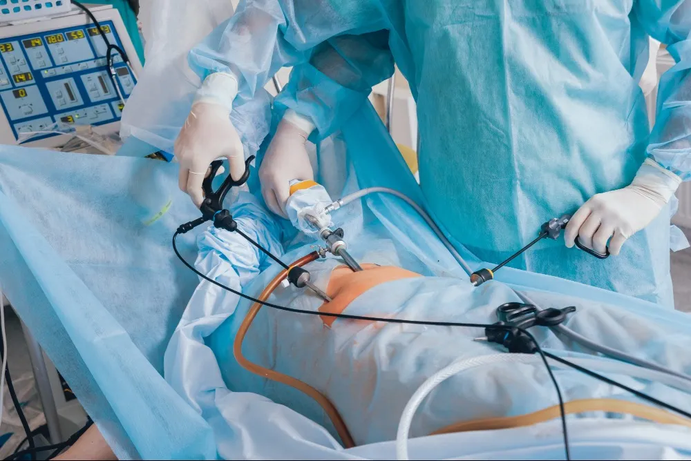 Laparoscopic Appendix Surgery in Sewri – A Modern Approach to Appendix Treatment