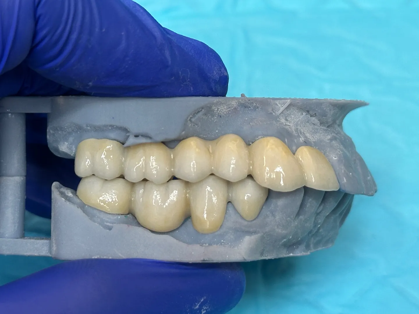 Why do my gums bleed when I brush?