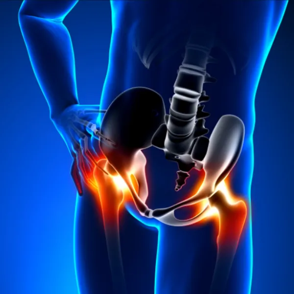Understanding Total Hip Replacement Treatment: A Complete Guide for Patients in Mumbai