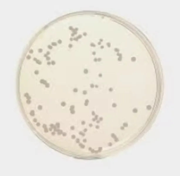 Dextrose Agar Uses and Why It Is Essential for Reliable Microbial Culture