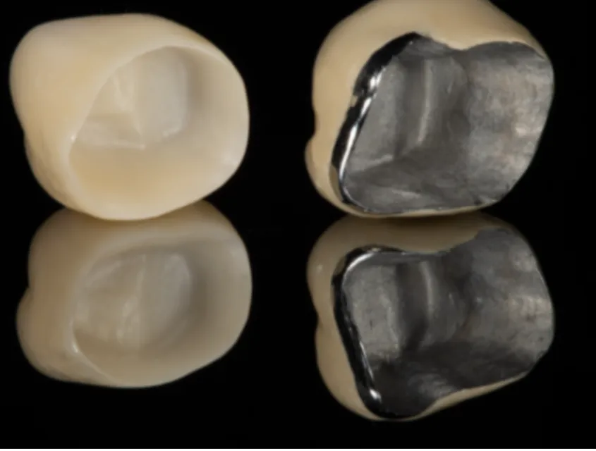 Fully Ceramic Crown Cap vs Other Dental Crowns: How to Choose the Right Option for Your Tooth